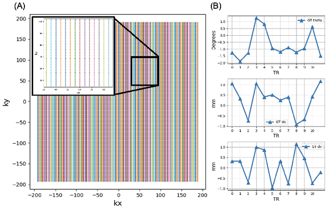 Figure 1 for Accelerated Motion Correction for MRI using Score-Based Generative Models