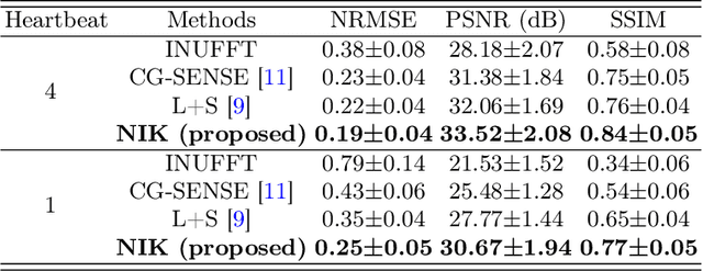 Figure 2 for Neural Implicit k-Space for Binning-free Non-Cartesian Cardiac MR Imaging