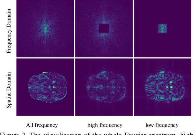 Figure 3 for FreMAE: Fourier Transform Meets Masked Autoencoders for Medical Image Segmentation