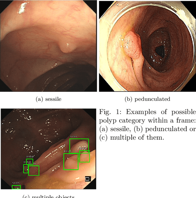 Figure 1 for Colonoscopy polyp detection with massive endoscopic images