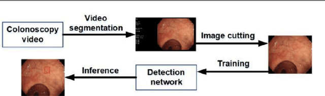Figure 3 for Colonoscopy polyp detection with massive endoscopic images