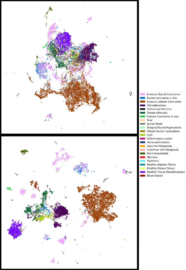 Figure 4 for Classification in Histopathology: A unique deep embeddings extractor for multiple classification tasks