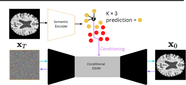 Figure 1 for Interpretable Alzheimer's Disease Classification Via a Contrastive Diffusion Autoencoder
