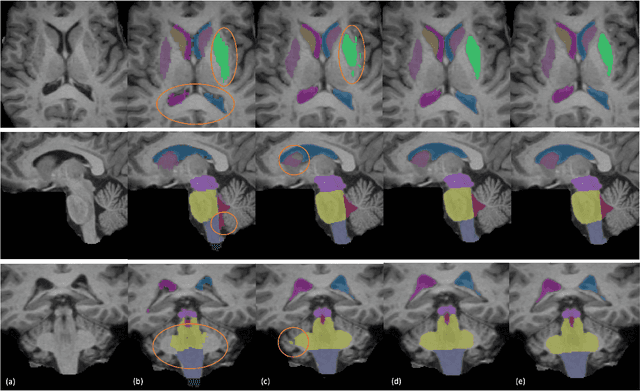 Figure 3 for Region-based U-net for accelerated training and enhanced precision in deep brain segmentation