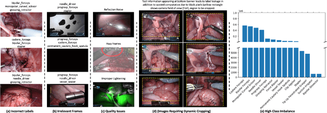 Figure 1 for Robust Surgical Tools Detection in Endoscopic Videos with Noisy Data