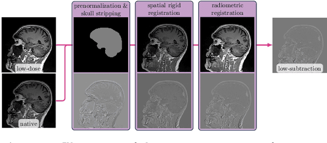 Figure 3 for Gadolinium dose reduction for brain MRI using conditional deep learning