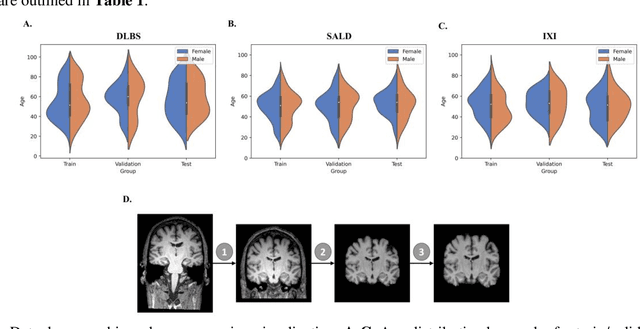 Figure 3 for Improving Across-Dataset Brain Tissue Segmentation Using Transformer