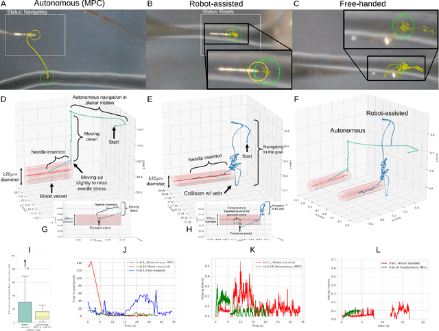 Figure 3 for Micromanipulation in Surgery: Autonomous Needle Insertion Inside the Eye for Targeted Drug Delivery