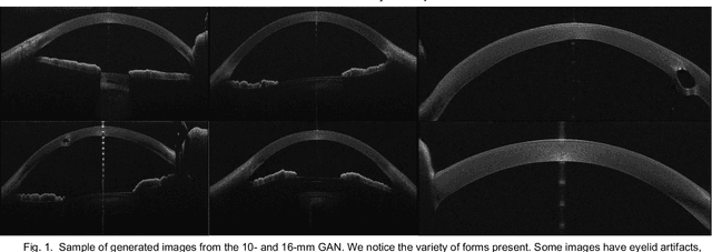 Figure 1 for Creating Realistic Anterior Segment Optical Coherence Tomography Images using Generative Adversarial Networks
