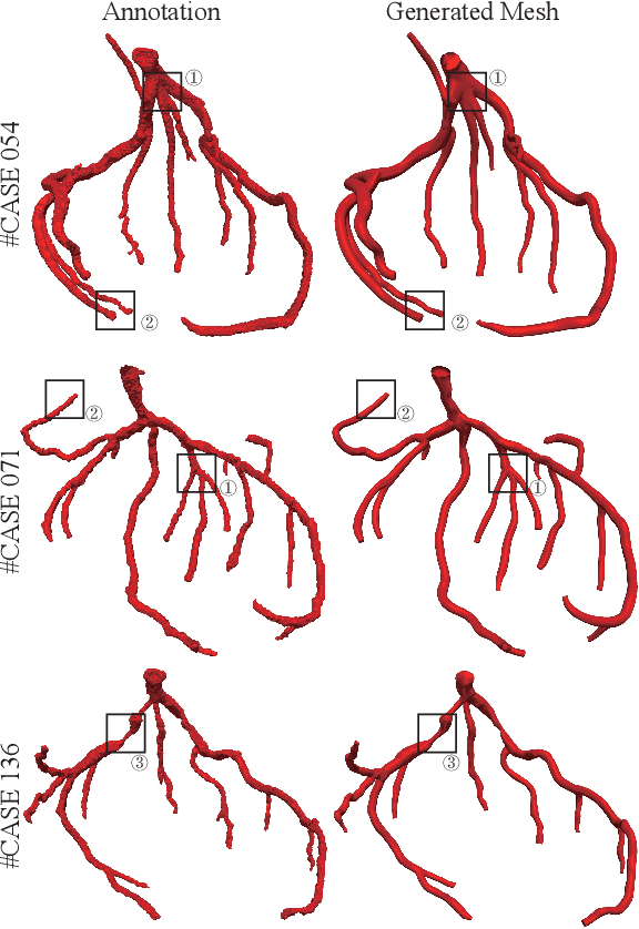 Figure 1 for Segmentation and Vascular Vectorization for Coronary Artery by Geometry-based Cascaded Neural Network