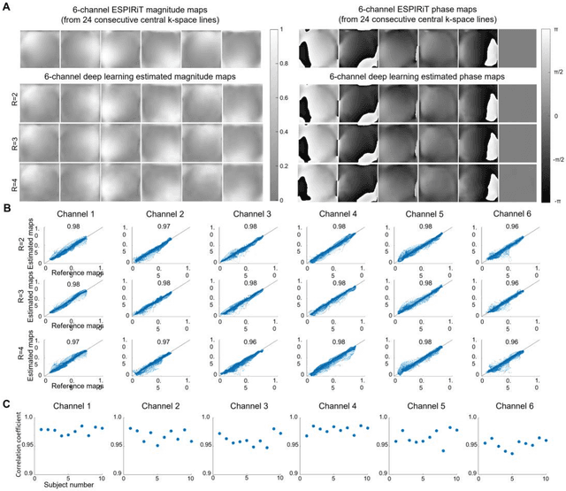 Figure 2 for Calibrationless Reconstruction of Uniformly-Undersampled Multi-Channel MR Data with Deep Learning Estimated ESPIRiT Maps