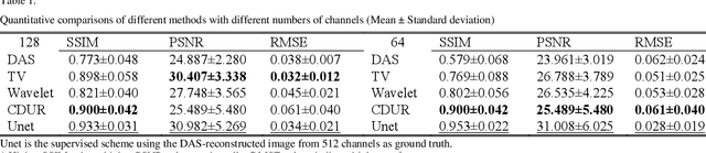 Figure 2 for Cross-domain Unsupervised Reconstruction with Equivariance for Photoacoustic Computed Tomography