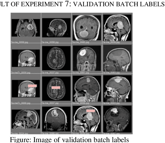 Figure 2 for Brain Cancer Segmentation Using YOLOv5 Deep Neural Network