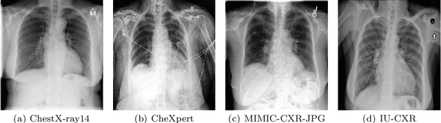 Figure 3 for Computer-Aided Diagnosis of Thoracic Diseases in Chest X-rays using hybrid CNN-Transformer Architecture