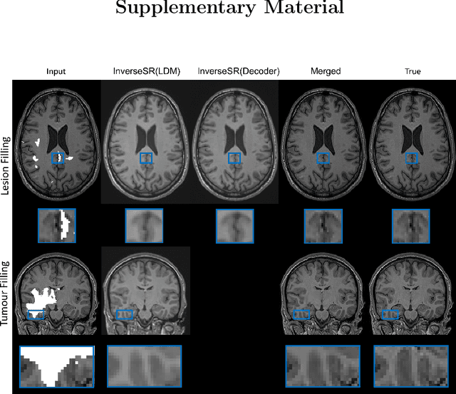 Figure 4 for InverseSR: 3D Brain MRI Super-Resolution Using a Latent Diffusion Model