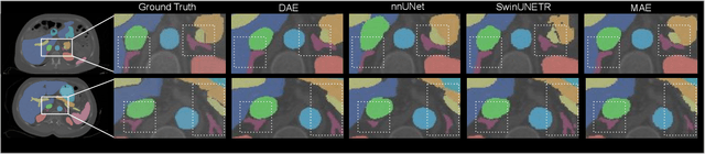 Figure 4 for Disruptive Autoencoders: Leveraging Low-level features for 3D Medical Image Pre-training