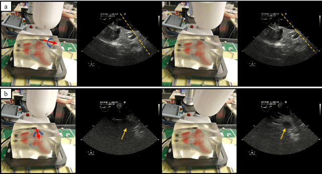 Figure 3 for Closed-Loop Magnetic Manipulation for Robotic Transesophageal Echocardiography