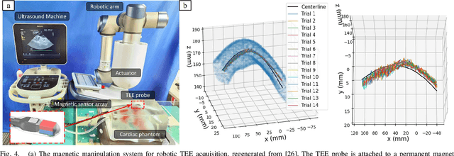 Figure 4 for Style Transfer Enabled Sim2Real Framework for Efficient Learning of Robotic Ultrasound Image Analysis Using Simulated Data