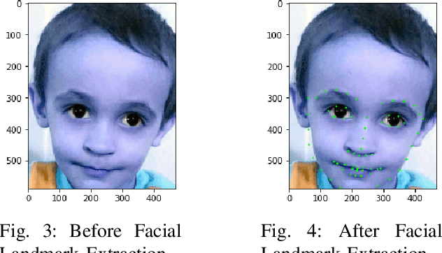 Figure 3 for A Federated Learning Scheme for Neuro-developmental Disorders: Multi-Aspect ASD Detection