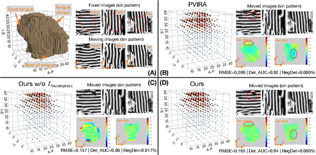 Figure 3 for Deep Unsupervised Phase-based 3D Incompressible Motion Estimation in Tagged-MRI
