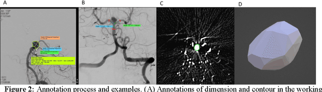 Figure 3 for Towards Automatic Prediction of Outcome in Treatment of Cerebral Aneurysms