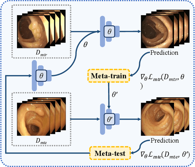 Figure 4 for Towards Discriminative Representation with Meta-learning for Colonoscopic Polyp Re-Identification