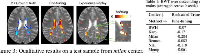 Figure 2 for Segmentation of Multiple Sclerosis Lesions across Hospitals: Learn Continually or Train from Scratch?