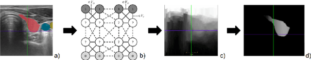 Figure 1 for Can ultrasound confidence maps predict sonographers' labeling variability?