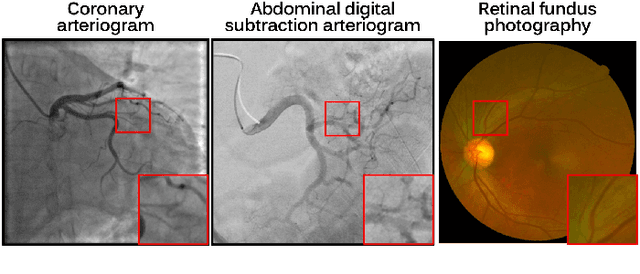 Figure 1 for C-DARL: Contrastive diffusion adversarial representation learning for label-free blood vessel segmentation