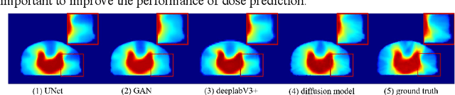 Figure 1 for DiffDP: Radiotherapy Dose Prediction via a Diffusion Model