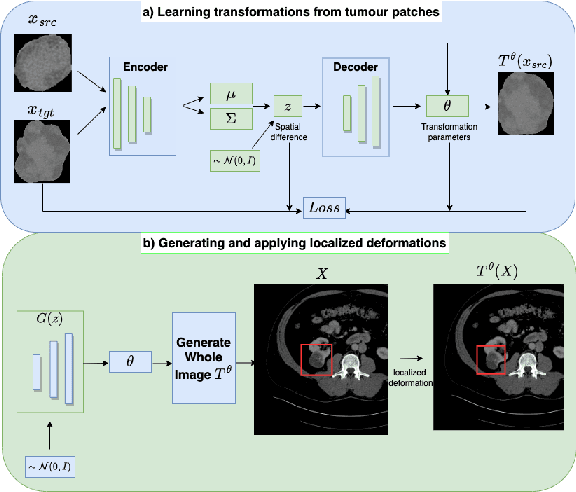 Figure 1 for Learning Transferable Object-Centric Diffeomorphic Transformations for Data Augmentation in Medical Image Segmentation