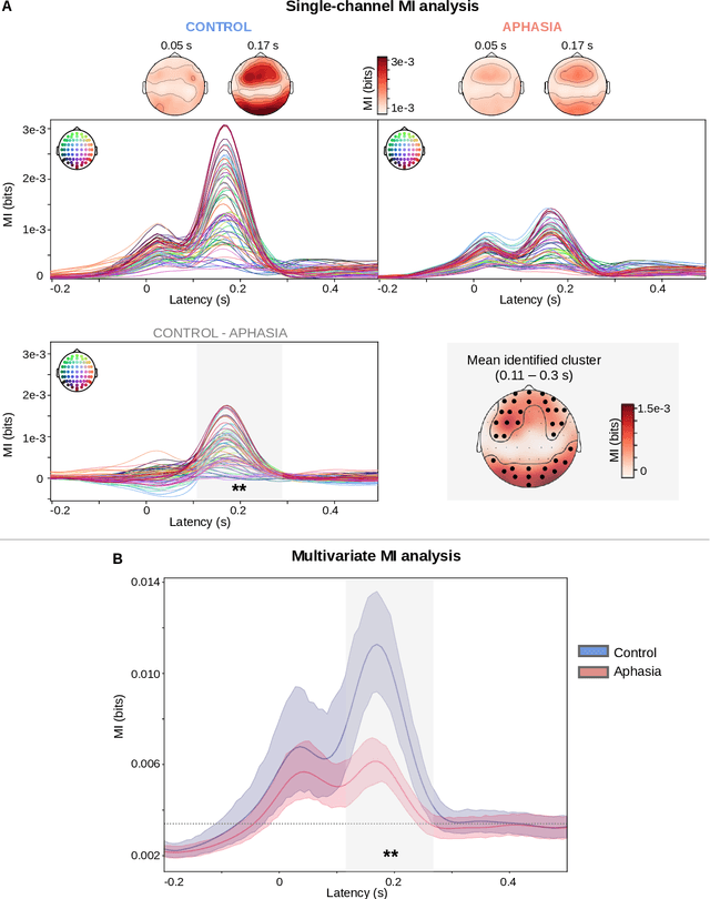 Figure 1 for Detecting post-stroke aphasia using EEG-based neural envelope tracking of natural speech