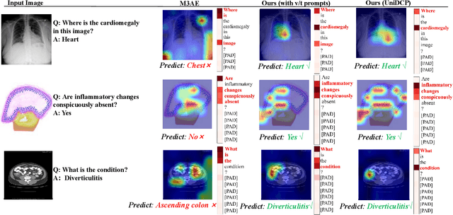 Figure 3 for UniDCP: Unifying Multiple Medical Vision-language Tasks via Dynamic Cross-modal Learnable Prompts
