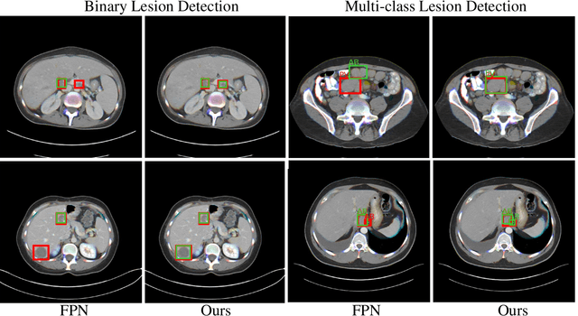 Figure 2 for FSD: Fully-Specialized Detector via Neural Architecture Search