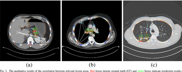 Figure 3 for FSD: Fully-Specialized Detector via Neural Architecture Search