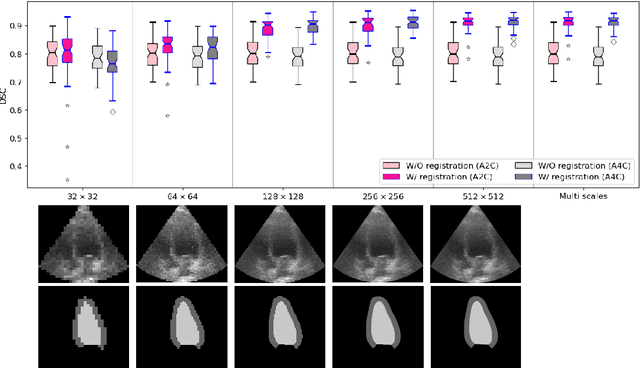 Figure 3 for Multi-scale, Data-driven and Anatomically Constrained Deep Learning Image Registration for Adult and Fetal Echocardiography