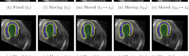Figure 4 for Multi-scale, Data-driven and Anatomically Constrained Deep Learning Image Registration for Adult and Fetal Echocardiography