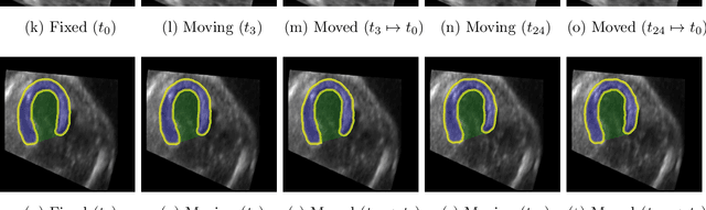 Figure 4 for Multi-scale, Data-driven and Anatomically Constrained Deep Learning Image Registration for Adult and Fetal Echocardiography