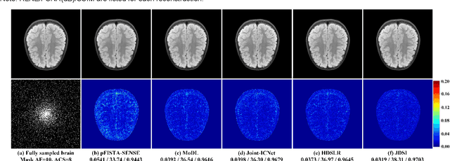 Figure 4 for A Faithful Deep Sensitivity Estimation for Accelerated Magnetic Resonance Imaging