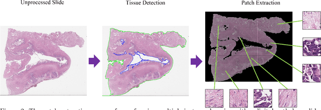 Figure 3 for Efficient subtyping of ovarian cancer histopathology whole slide images using active sampling in multiple instance learning