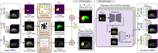 Figure 1 for Mask-guided Data Augmentation for Multiparametric MRI Generation with a Rare Hepatocellular Carcinoma
