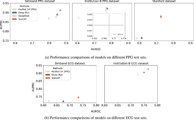 Figure 3 for SiamAF: Learning Shared Information from ECG and PPG Signals for Robust Atrial Fibrillation Detection