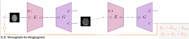 Figure 4 for A2V: A Semi-Supervised Domain Adaptation Framework for Brain Vessel Segmentation via Two-Phase Training Angiography-to-Venography Translation