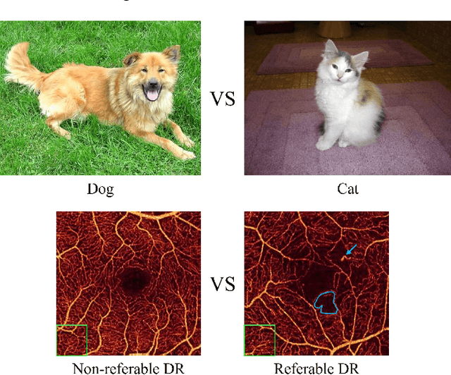 Figure 1 for Interpretable Diabetic Retinopathy Diagnosis based on Biomarker Activation Map