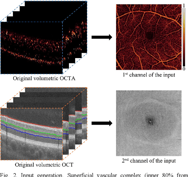 Figure 2 for Interpretable Diabetic Retinopathy Diagnosis based on Biomarker Activation Map