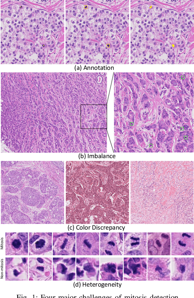 Figure 1 for Rethinking Mitosis Detection: Towards Diverse Data and Feature Representation