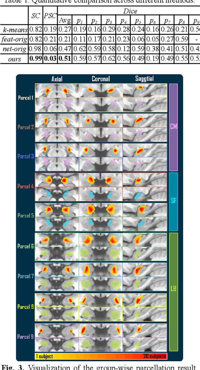 Figure 3 for A Novel Deep Clustering Framework for Fine-Scale Parcellation of Amygdala Using dMRI Tractography