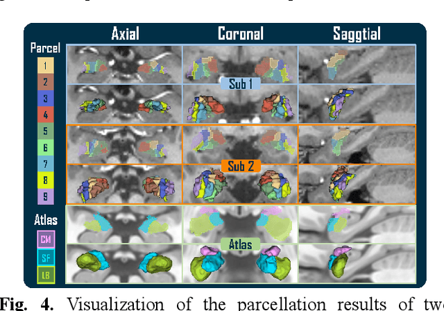 Figure 4 for A Novel Deep Clustering Framework for Fine-Scale Parcellation of Amygdala Using dMRI Tractography