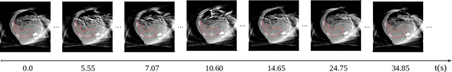 Figure 4 for Liver Segmentation in Time-resolved C-arm CT Volumes Reconstructed from Dynamic Perfusion Scans using Time Separation Technique