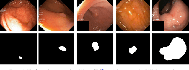 Figure 3 for RUPNet: Residual upsampling network for real-time polyp segmentation